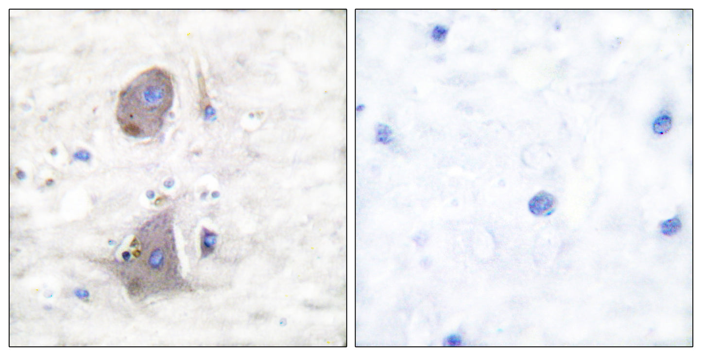 Glut1 Rabbit Polyclonal Antibody