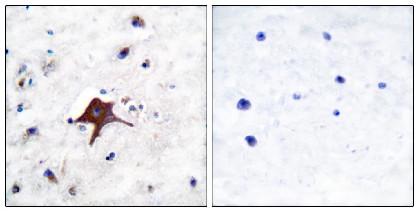 Glut3 Rabbit Polyclonal Antibody