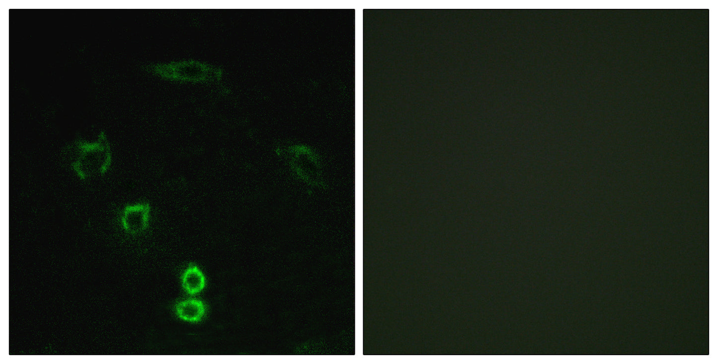 Glycerate Kinase Rabbit Polyclonal Antibody