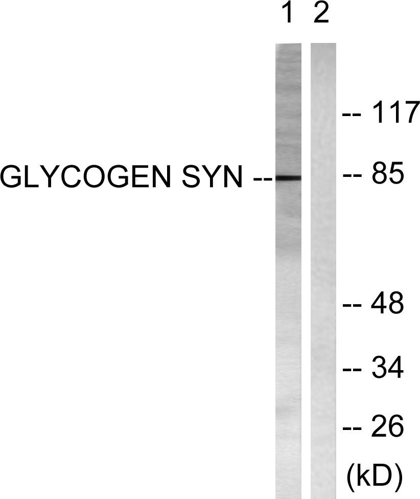 Glycogen Synthase 1 Rabbit Polyclonal Antibody