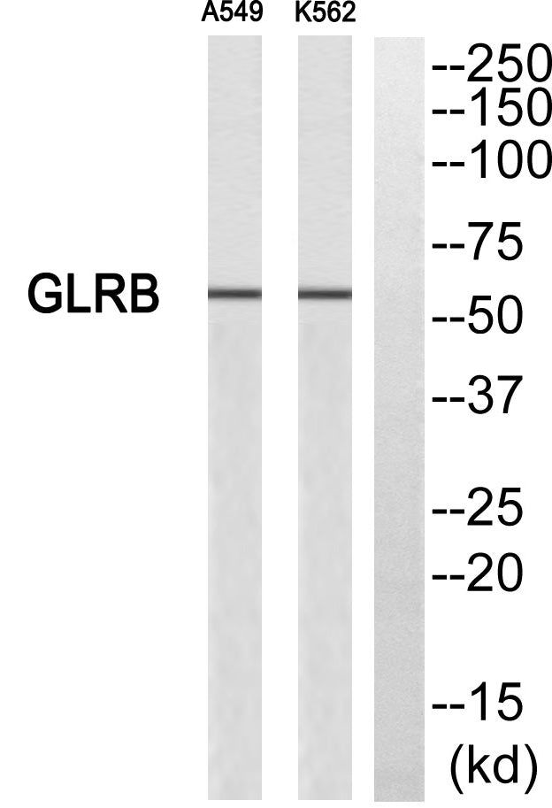 GlyRβ Rabbit Polyclonal Antibody