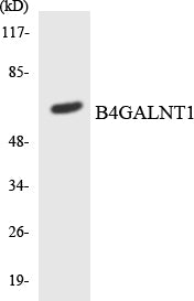 GM2/GD2 synthase Rabbit Polyclonal Antibody