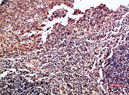 GM-CSF Rabbit Polyclonal Antibody