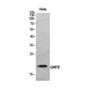 GMF-β Rabbit Polyclonal Antibody