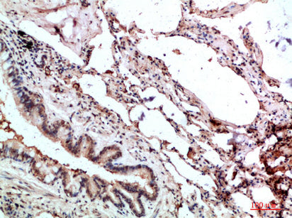 GMF-γ Rabbit Polyclonal Antibody