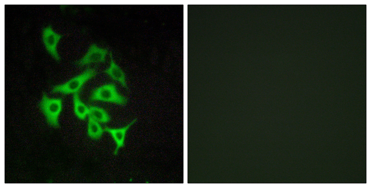 GPR100 Rabbit Polyclonal Antibody