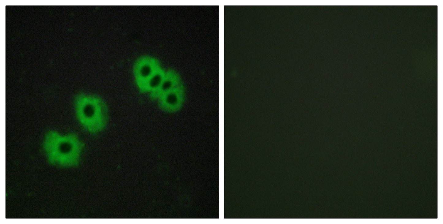 GPR105 Rabbit Polyclonal Antibody