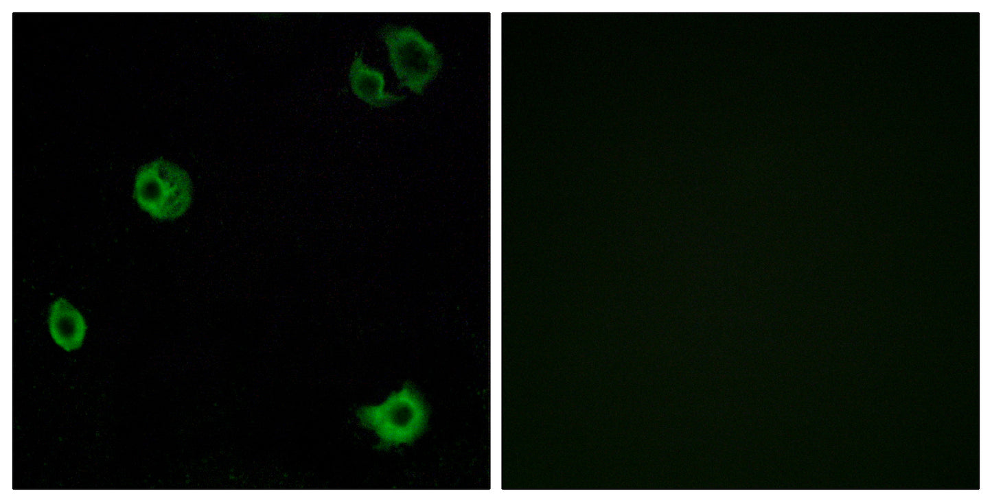 GPR110 Rabbit Polyclonal Antibody