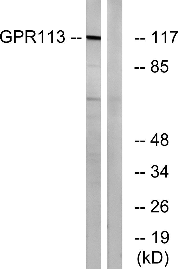 GPR113 Rabbit Polyclonal Antibody