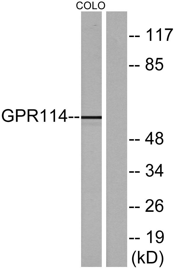 GPR114 Rabbit Polyclonal Antibody