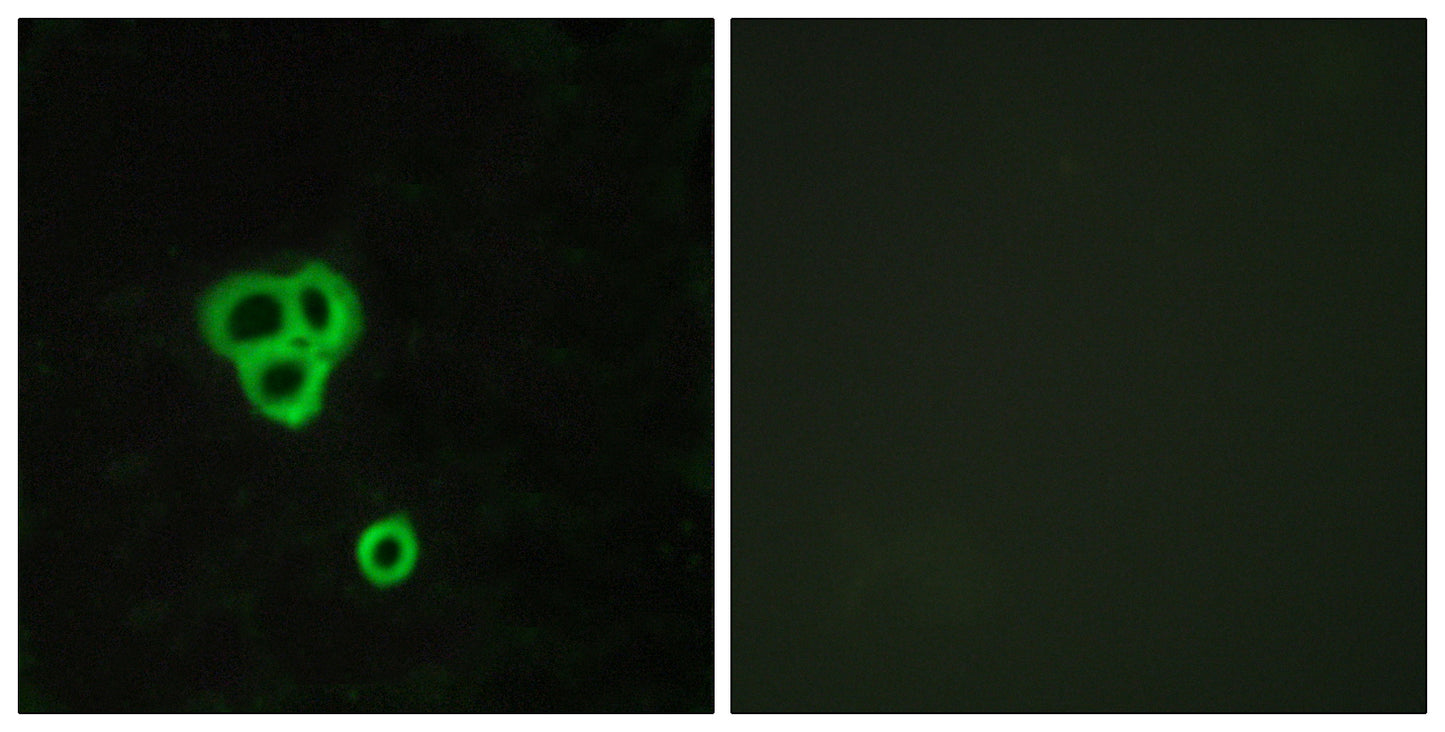 GPR119 Rabbit Polyclonal Antibody