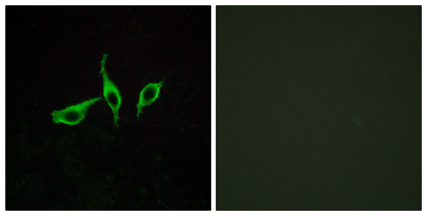 GPR120 Rabbit Polyclonal Antibody