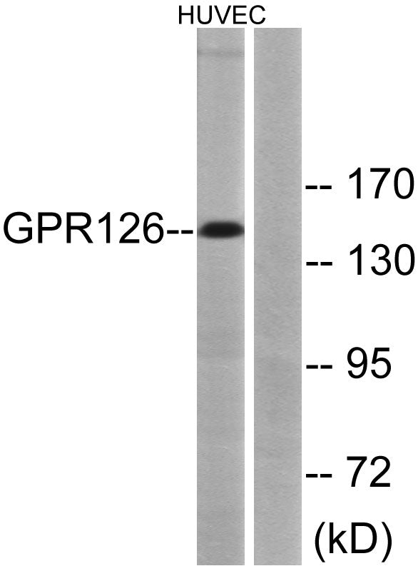 GPR126 Rabbit Polyclonal Antibody