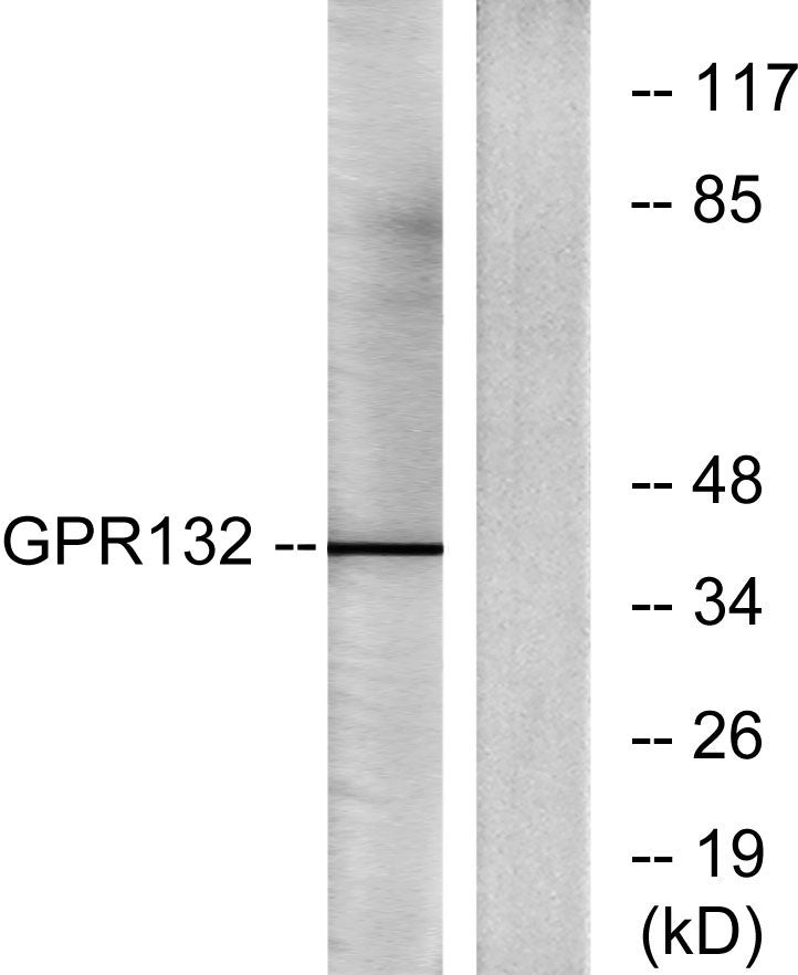 GPR132 Rabbit Polyclonal Antibody