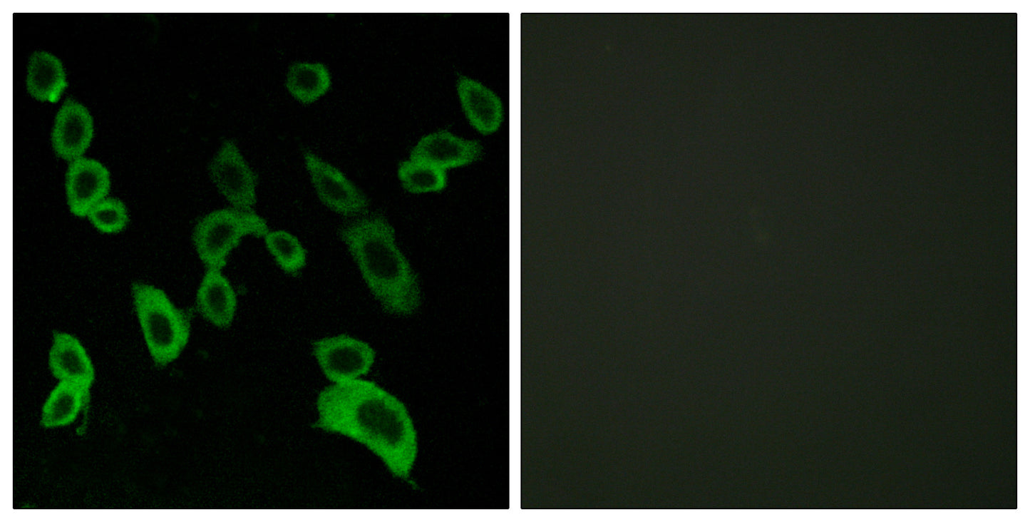 GPR139 Rabbit Polyclonal Antibody