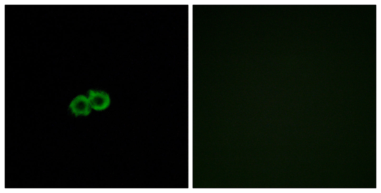 GPR142 Rabbit Polyclonal Antibody