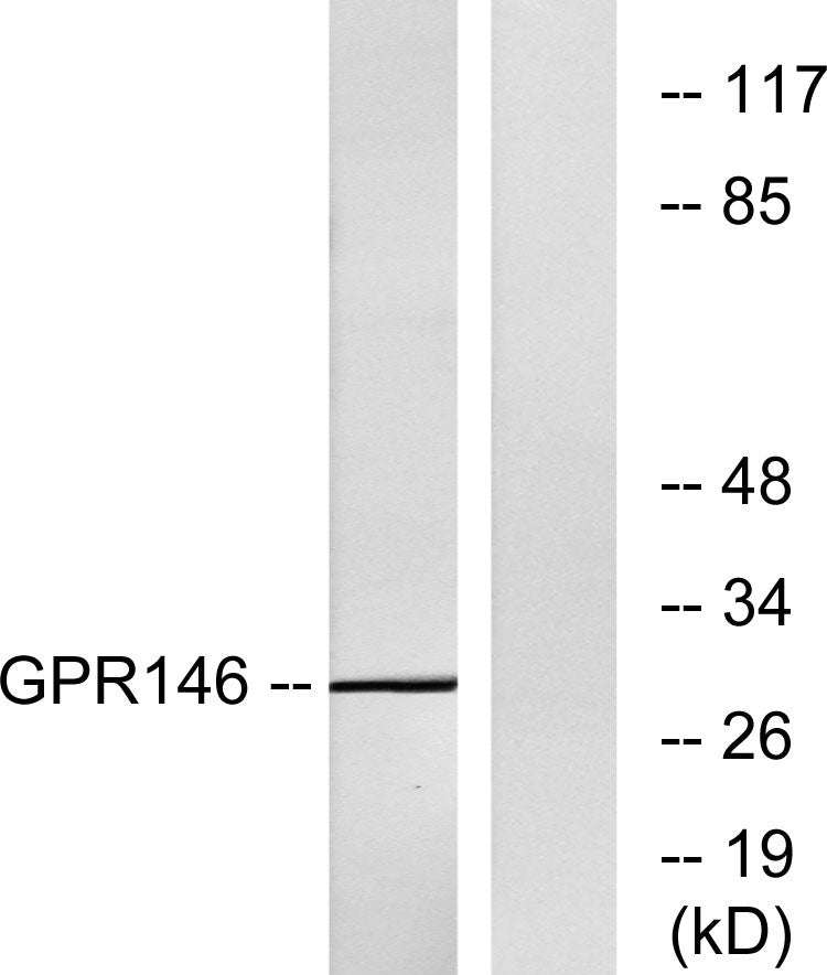 GPR146 Rabbit Polyclonal Antibody