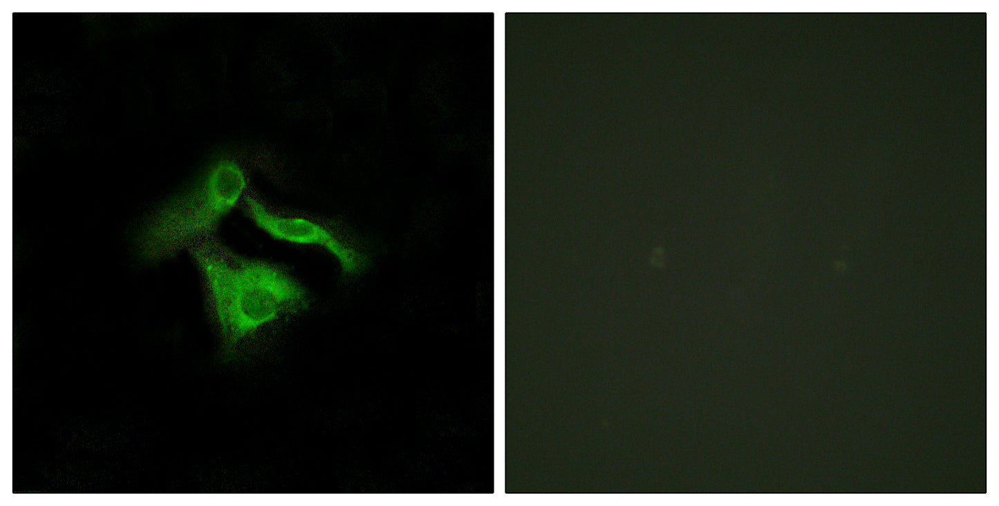 GPR149 Rabbit Polyclonal Antibody