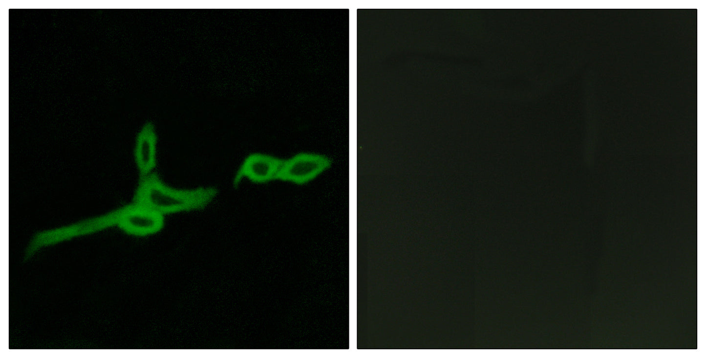 GPR15 Rabbit Polyclonal Antibody