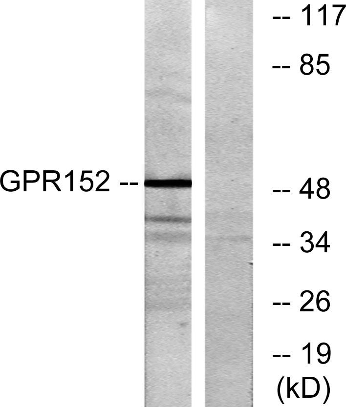 GPR152 Rabbit Polyclonal Antibody