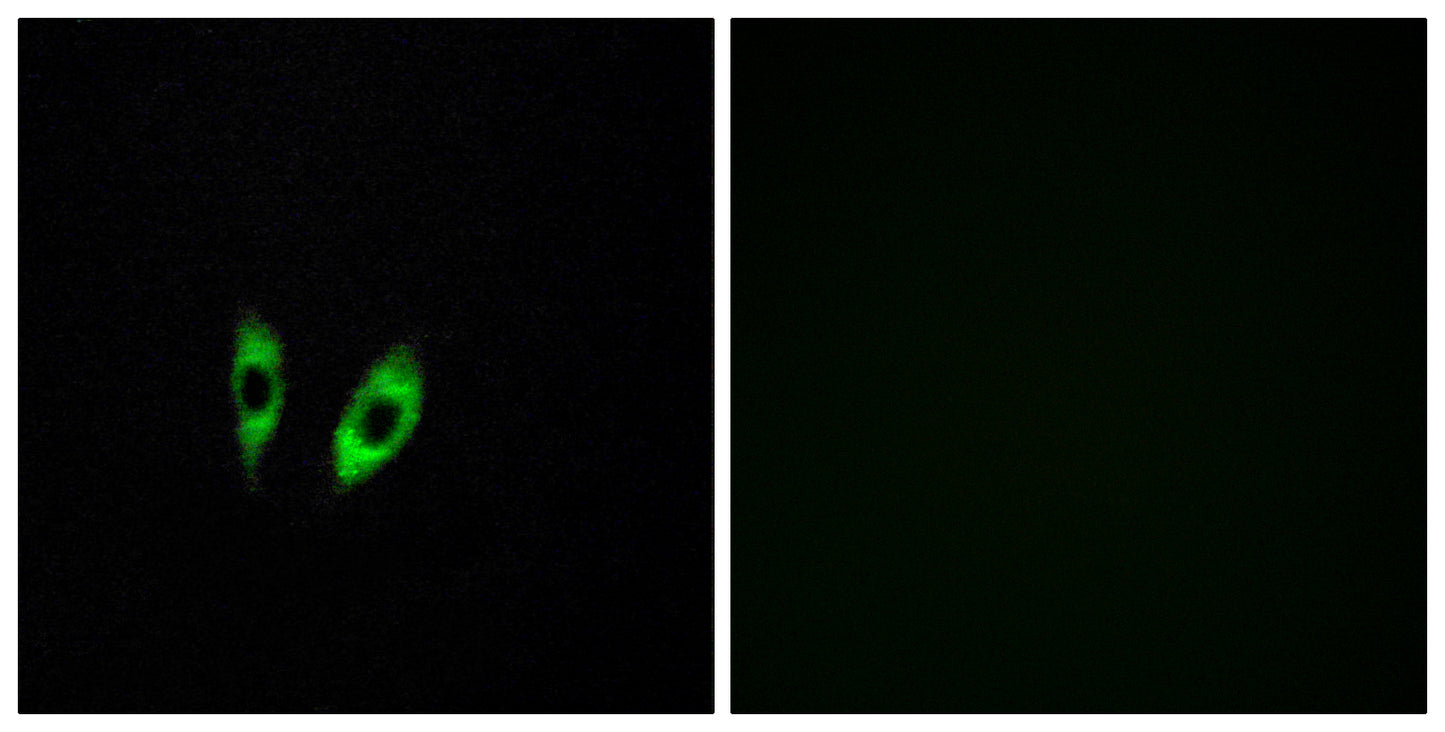 GPR156 Rabbit Polyclonal Antibody