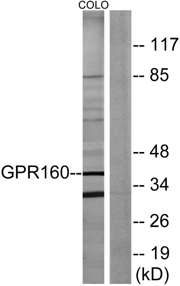 GPR160 Rabbit Polyclonal Antibody