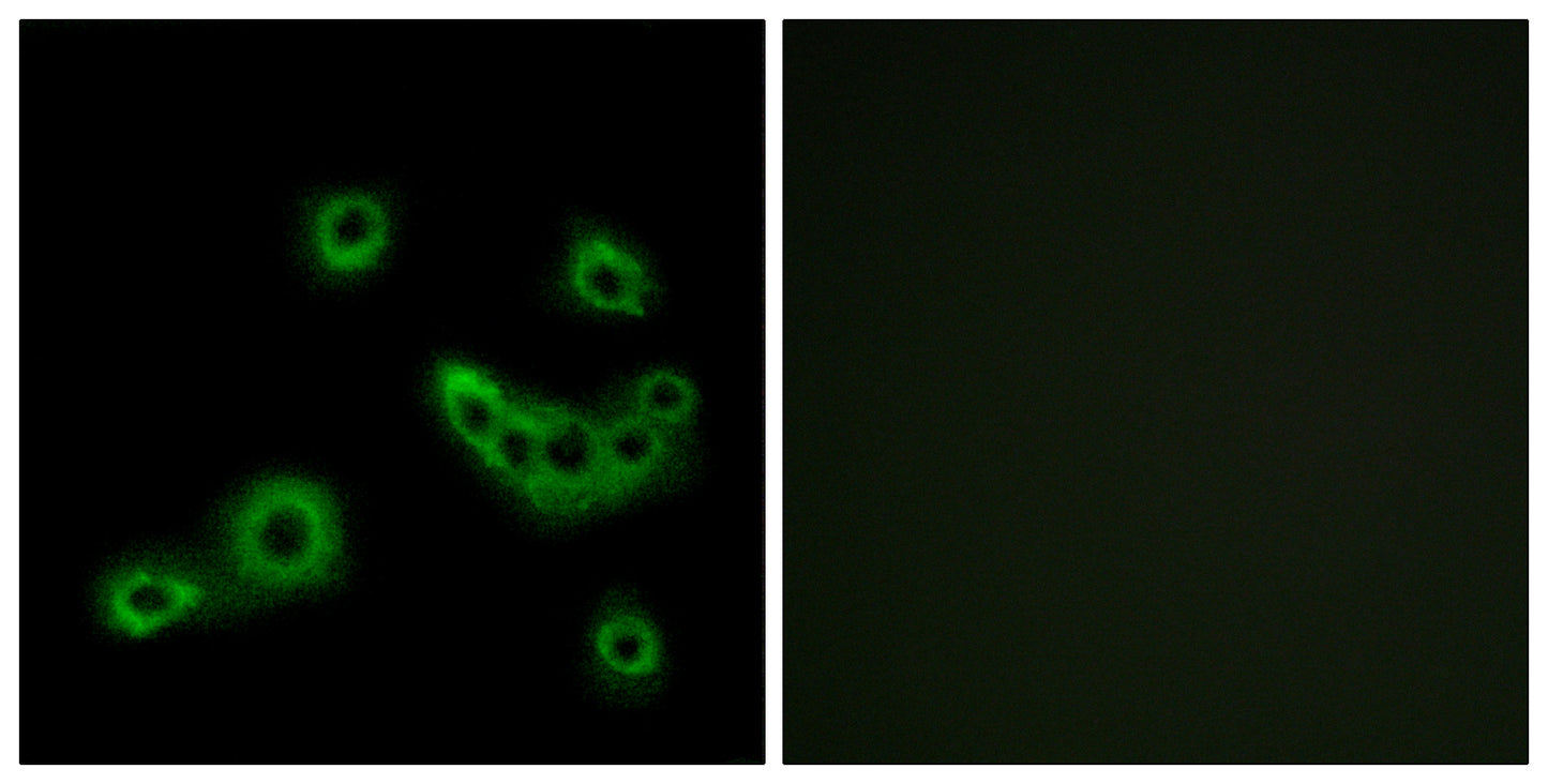 GPR172B Rabbit Polyclonal Antibody