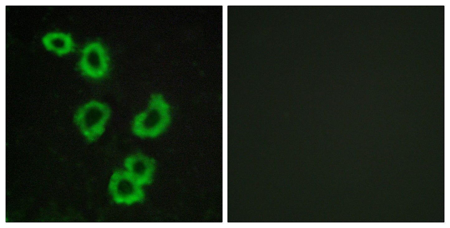 GPR176 Rabbit Polyclonal Antibody