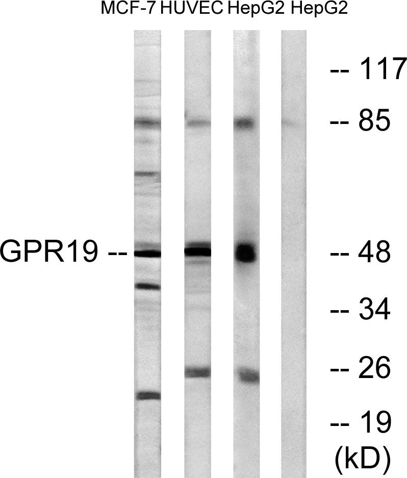GPR19 Rabbit Polyclonal Antibody