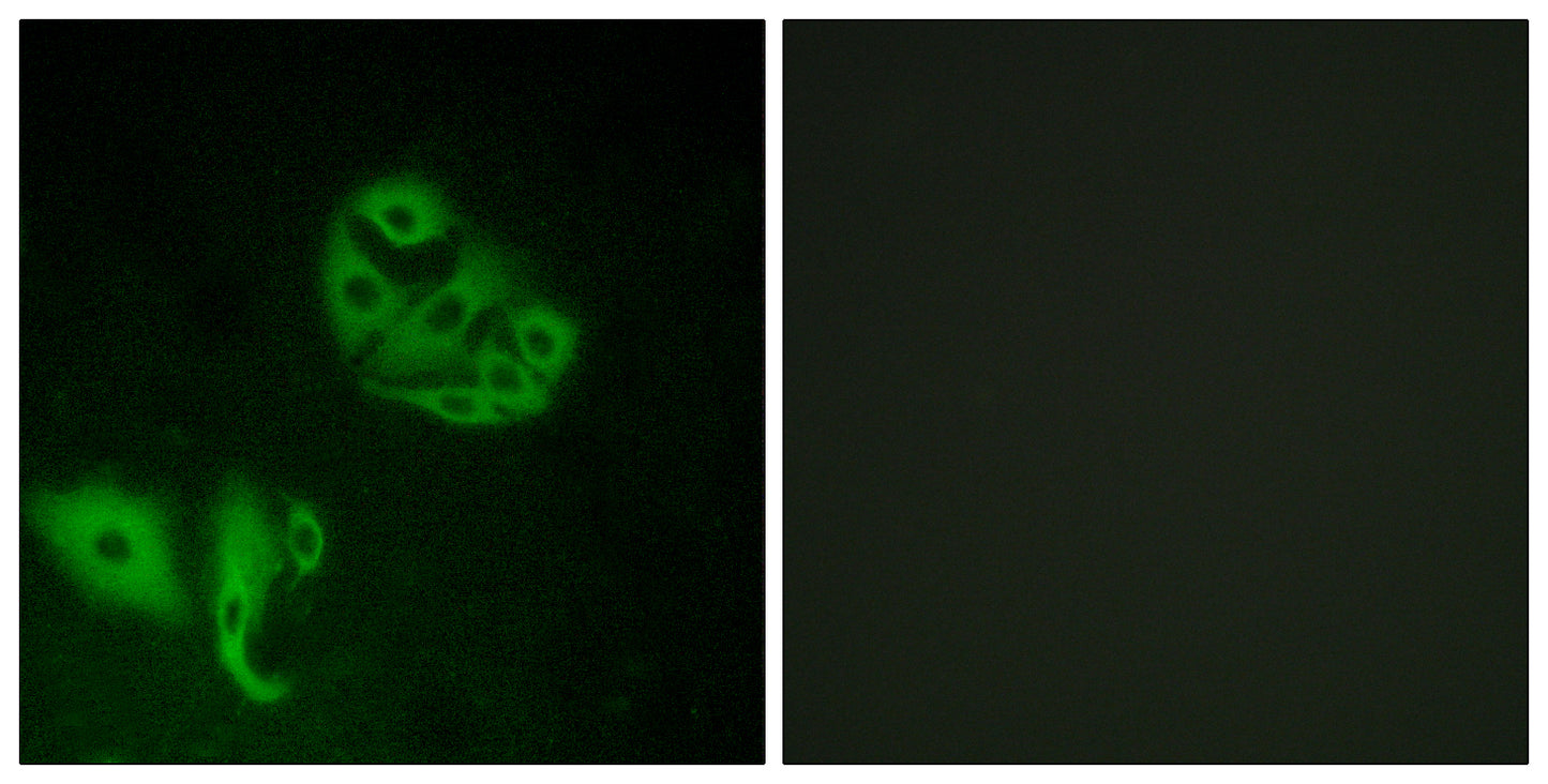 GPR20 Rabbit Polyclonal Antibody