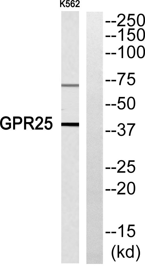 GPR25 Rabbit Polyclonal Antibody