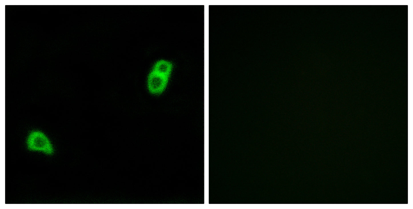 GPR34 Rabbit Polyclonal Antibody