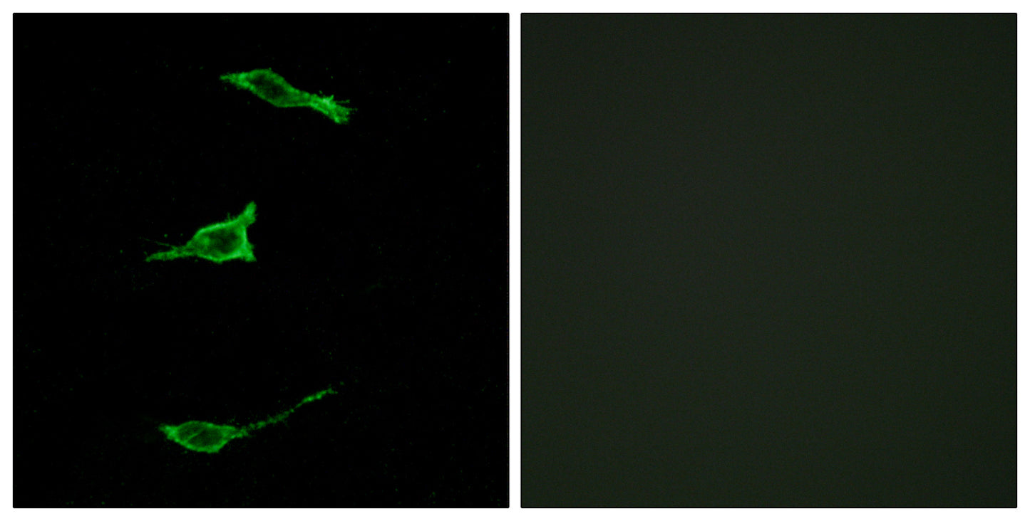 GPR40 Rabbit Polyclonal Antibody