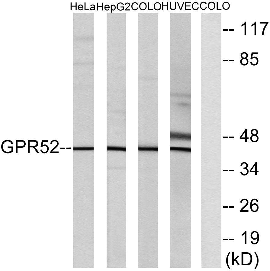GPR52 Rabbit Polyclonal Antibody