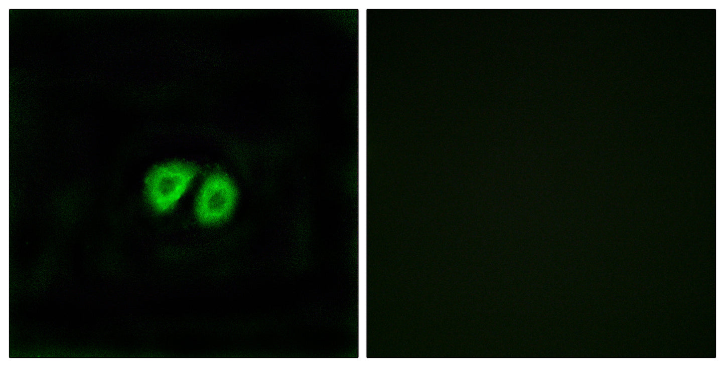 GPR56 Rabbit Polyclonal Antibody