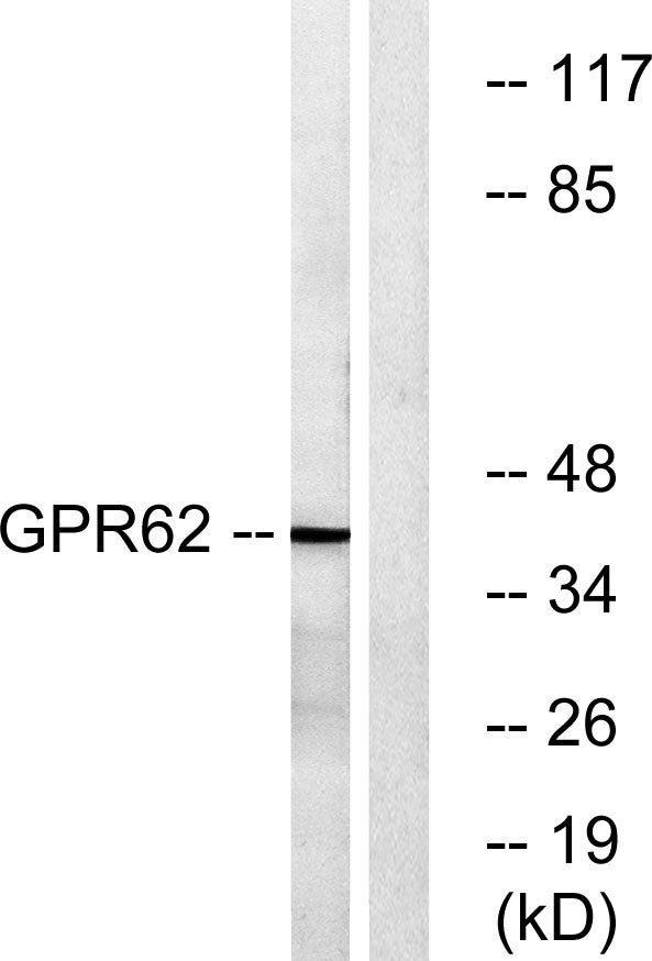 GPR62 Rabbit Polyclonal Antibody