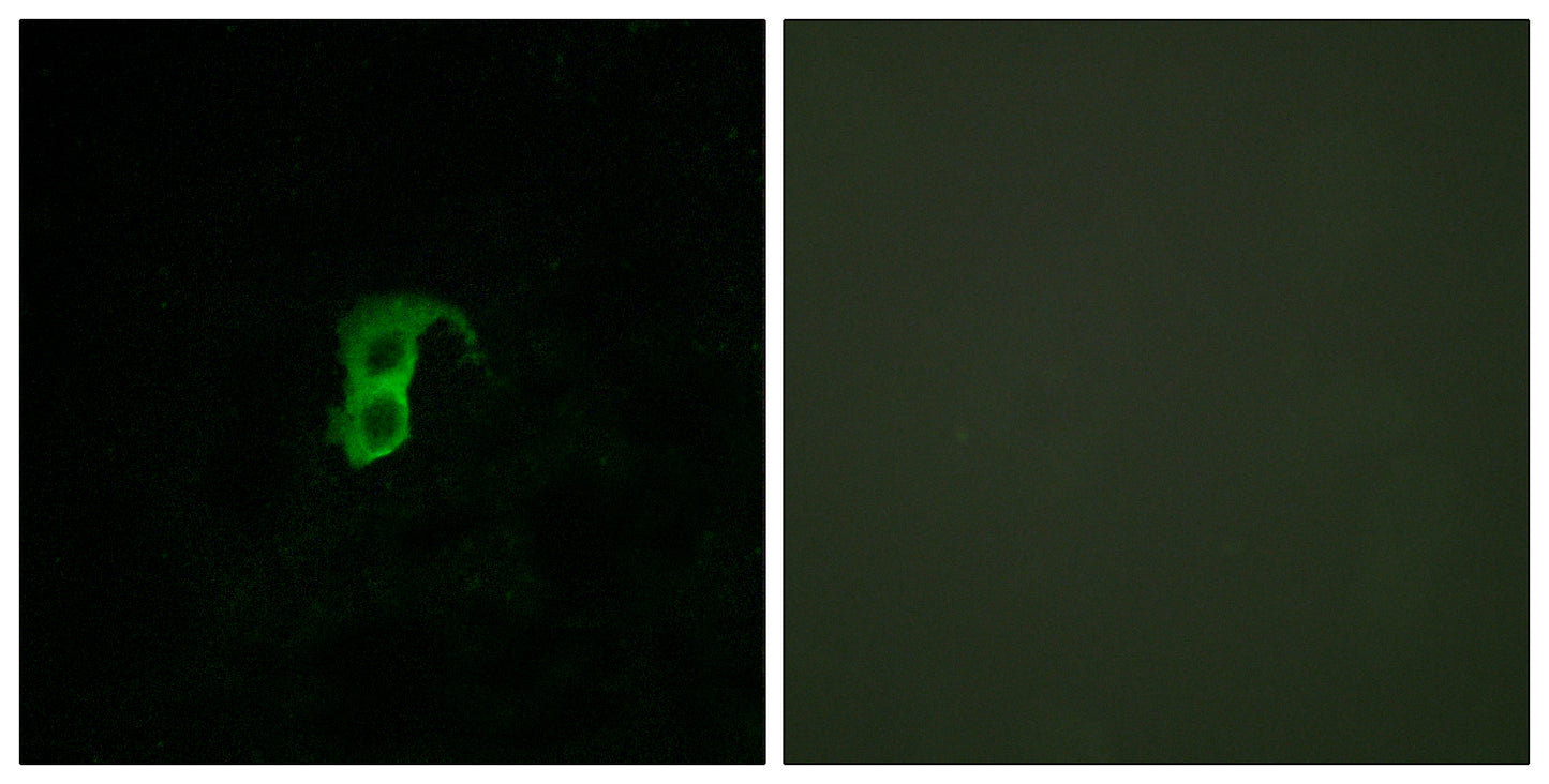 GPR87 Rabbit Polyclonal Antibody