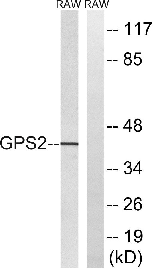 GPS2 Rabbit Polyclonal Antibody