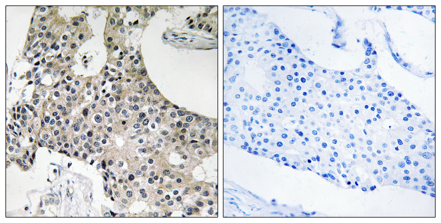 GPSN2 Rabbit Polyclonal Antibody