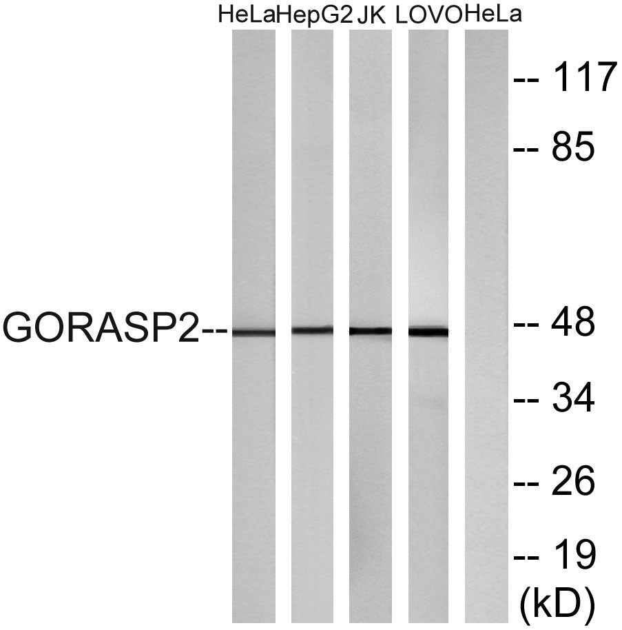 GRASP55 Rabbit Polyclonal Antibody