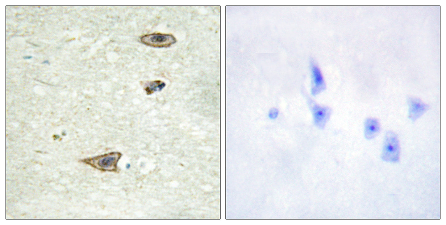 GRK 1 Rabbit Polyclonal Antibody