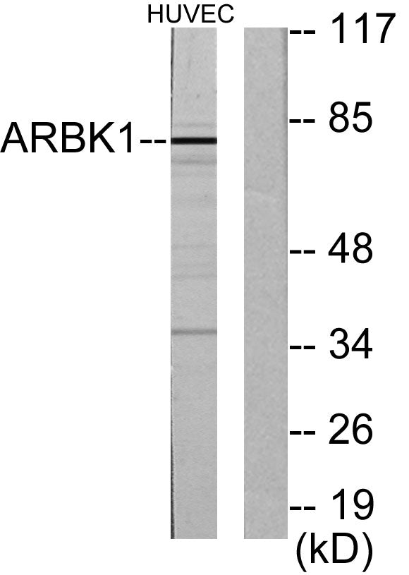 GRK 2 Rabbit Polyclonal Antibody