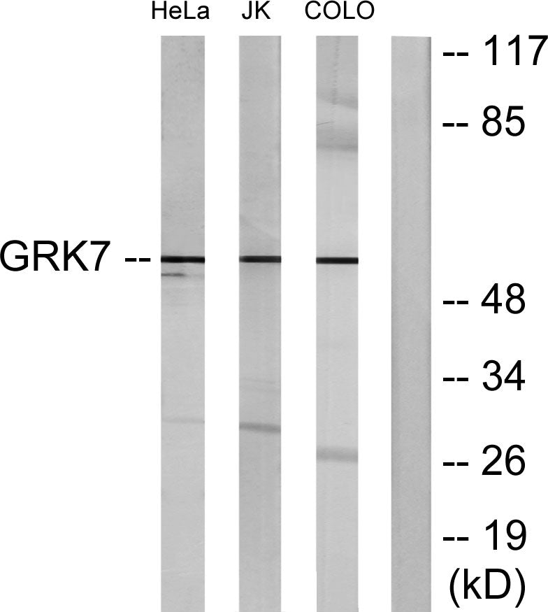 GRK 7 Rabbit Polyclonal Antibody