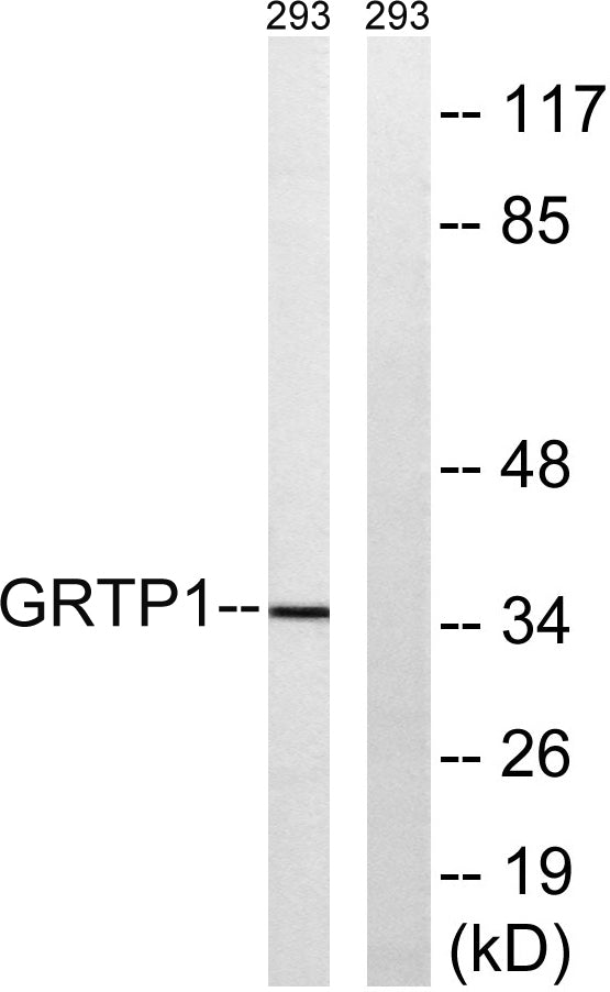 GRTP1 Rabbit Polyclonal Antibody
