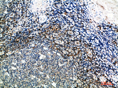 GSC Rabbit Polyclonal Antibody