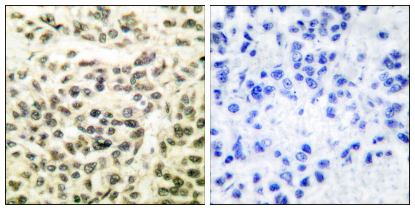 GSK3α/β Rabbit Polyclonal Antibody