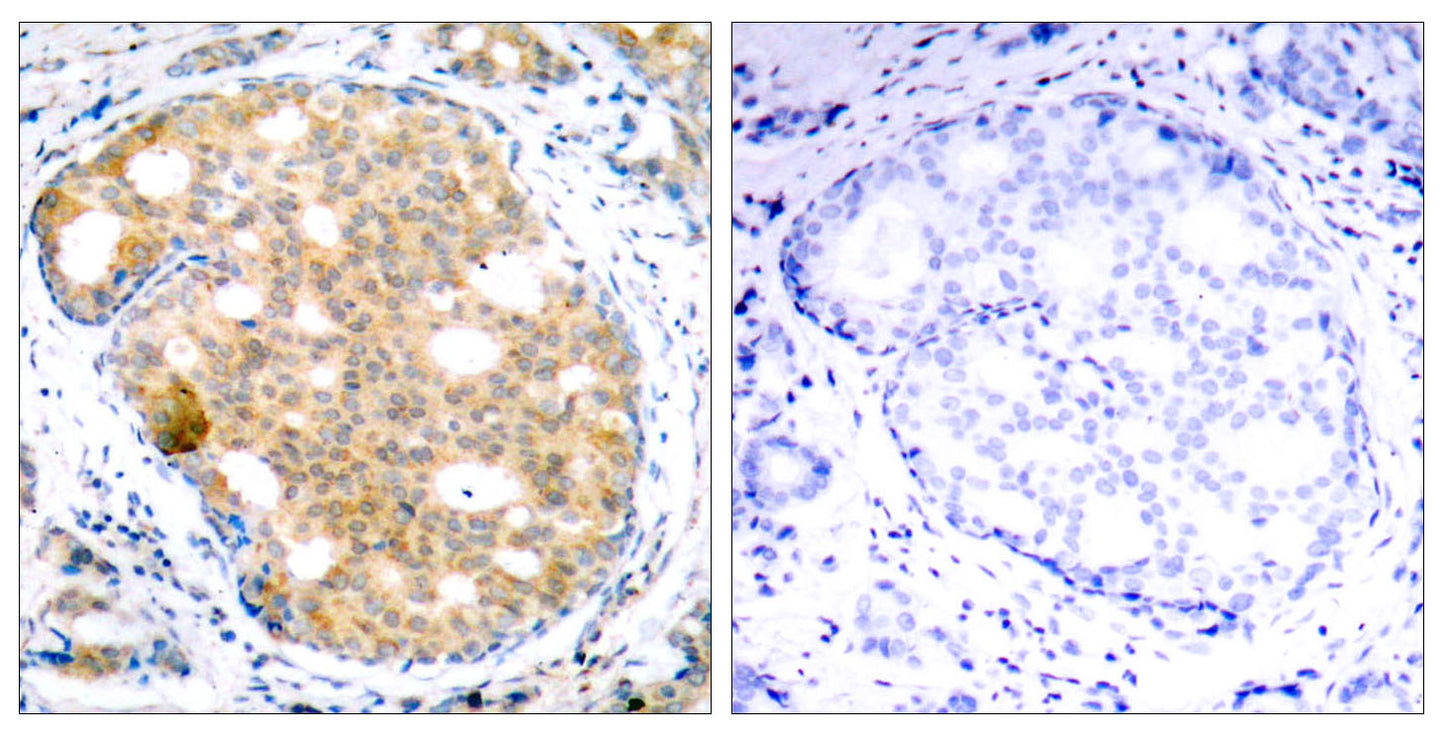 GSK3β Rabbit Polyclonal Antibody