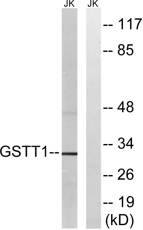 GSTT1/4 Rabbit Polyclonal Antibody