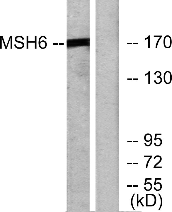 GTBP Rabbit Polyclonal Antibody