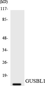 GUSBP1 Rabbit Polyclonal Antibody